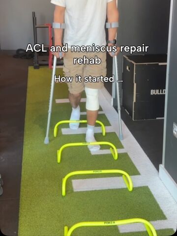 6 months post ACL + meniscus repair @kaysar.l.abdullah has smashed his rehab. By 4.5 months he’d hit: ✅ 2x bodyweight on the single-leg press ✅ Just 2% quad strength asymmetry on the VALD dynamometer…